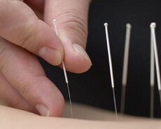 İqla terapiya iynesi