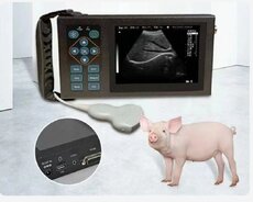 Ultrasəs cihazı 