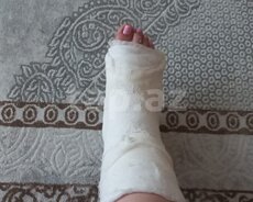 Sınıqçı xidməti